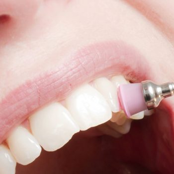 Professionelle Zahnpflege schützt die Zähne und erhält ihren Wert und ihre Schönheit